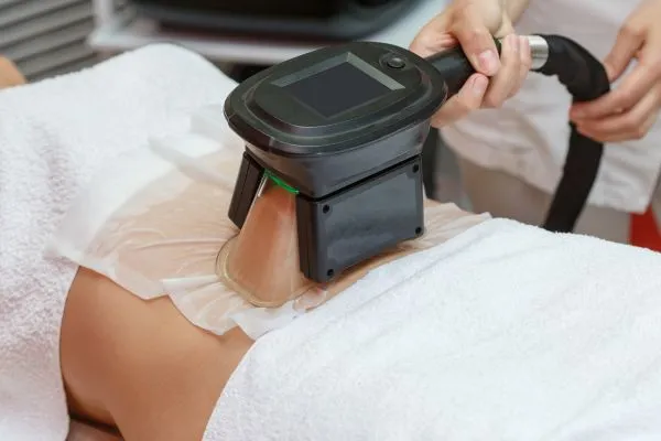 Image of person having fat freezing treatment to help weight gain Witley