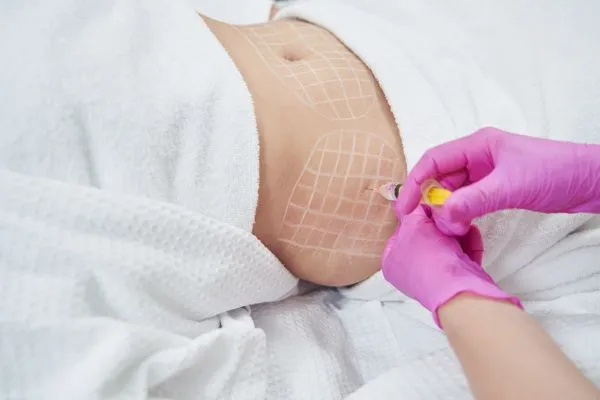 image of fat dissolving injections on love handles to help combat weight gain Witley