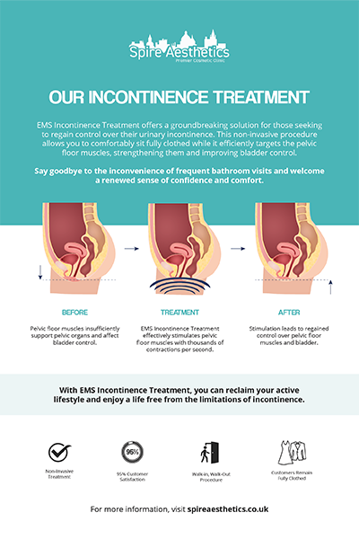 image of how urge incontinence Witley treatment works