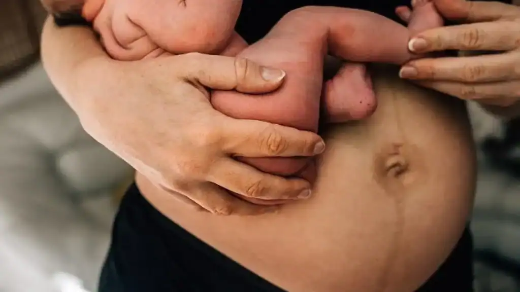 Why Is My Stomach Still Big After Pregnancy Witley?